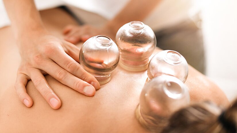 Eine Therapeutin führt bei einer Dame eine Schröpfkopfmassage durch.